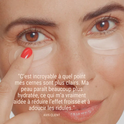 Patchs  micro-needling Acide Hyaluronique - Anti rides et ridules